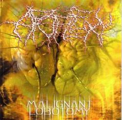 Apoplexy (USA) : Malignant Lobotomy